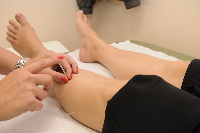 Things to Know When Visiting an Acupuncture Center in Houston