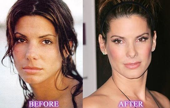 9 Celebrities Who Had Amazing Plastic &#038; Cosmetic Surgery