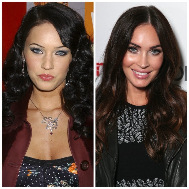 9 Celebrities Who Had Amazing Plastic &#038; Cosmetic Surgery