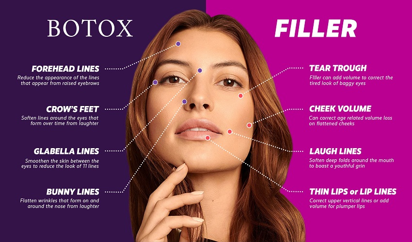 How Do Botox and Fillers Differ