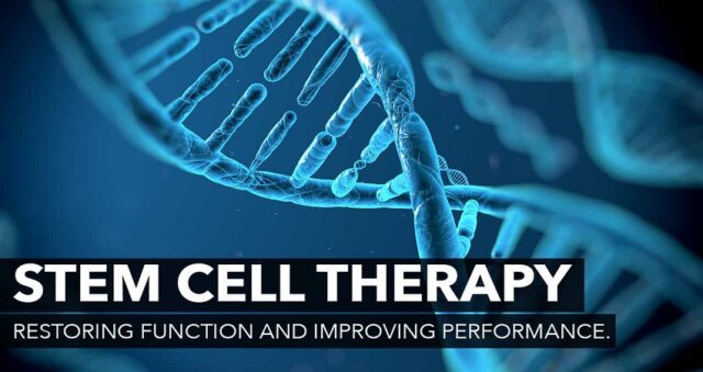 Things to Consider in Mind About Stem Cell Therapy